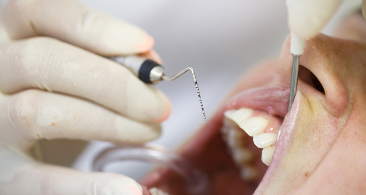 Periodontal flap surgery