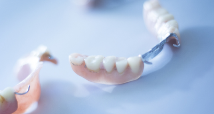 Removable partial denture