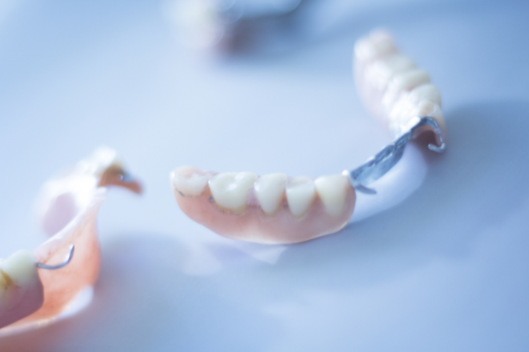 Removable partial denture