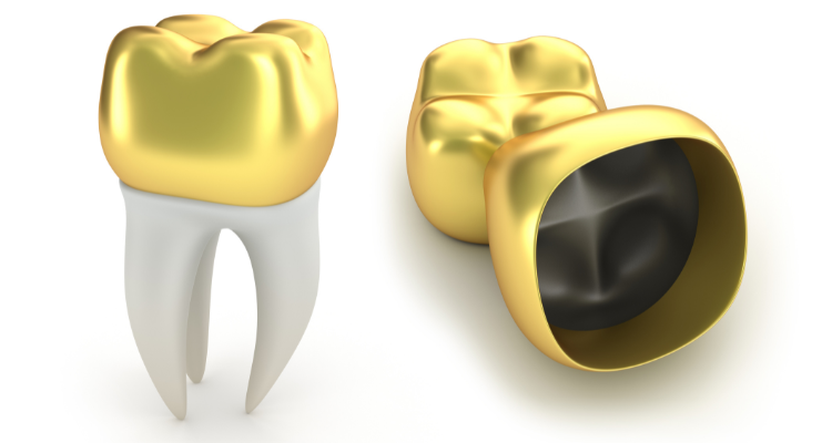 Tooth jewelry