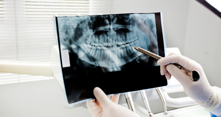 Digital X-Ray