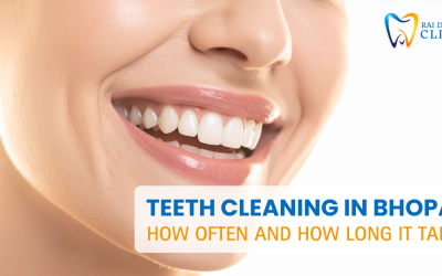 Teeth Cleaning in Bhopal – How Often and How Long It Takes
