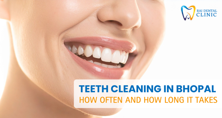 Teeth Cleaning in Bhopal – How Often and How Long It Takes